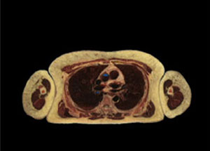 "Divining Fragments: Reconciling the Body", curated by Koán-Jeff Baysa, November 1 - December 21, 2003