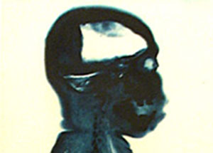 "Divining Fragments: Reconciling the Body", curated by Koán-Jeff Baysa, November 1 - December 21, 2003